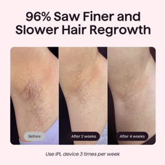 HerSkin Premium Ice Cool IPL Laser Device